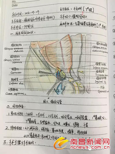 90后護(hù)士手術(shù)筆記走紅:記手術(shù)筆記是本職工作