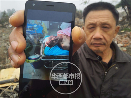 父親王慶和展示自己被打傷的照片