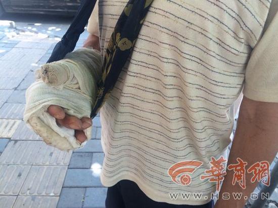 7��22�����A�̈�(b��o)ӛ��ݚ�D(zhu��n)(li��n)ϵ���˹��^��ĳ�����f(shu��)�ѽ�(j��ng)�o�Ύ����|���˽��f(w��n)Ԫ���ί��M(f��i)�����F(xi��n)�����](m��i)�X(qi��n)�ˣ��o(w��)�ܞ��������P�hס����ؓ(f��)؟(z��)���µĹ����ˆT�t�f(shu��)���Ύ����ǹ��^���M(j��n)ȥ�ɻ��������ֻؓ(f��)؟(z��)�{(di��o)��������B(t��i)���^�m(x��)�ش��й�������̎�����¡�